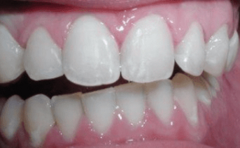 aesthetic-repair gallery