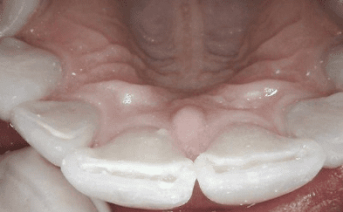 aesthetic-repair gallery