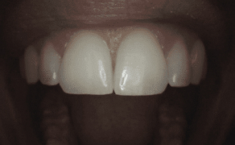 aesthetic-repair gallery