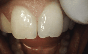 aesthetic-repair gallery