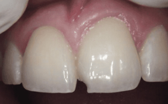 aesthetic-repair gallery