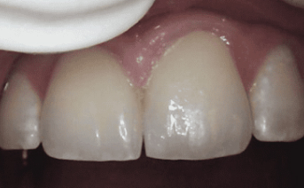 aesthetic-repair gallery