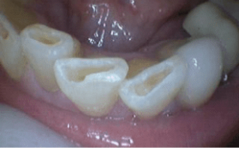 aesthetic-repair gallery