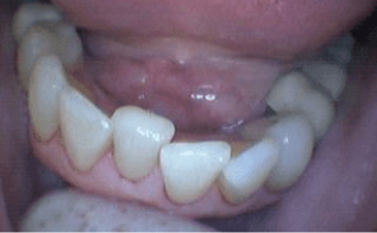 aesthetic-repair gallery