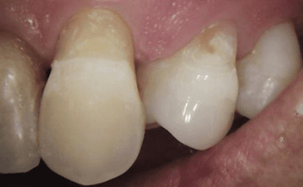 aesthetic-repair gallery