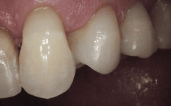 aesthetic-repair gallery