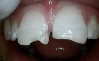 aesthetic-repair gallery