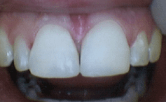 aesthetic-repair gallery