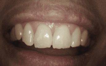 aesthetic-repair gallery