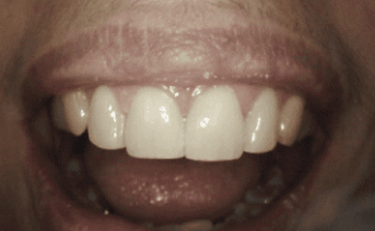 aesthetic-repair gallery