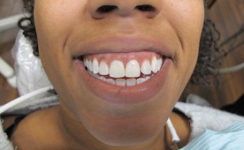 aesthetic-repair gallery