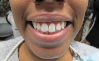 aesthetic-repair gallery